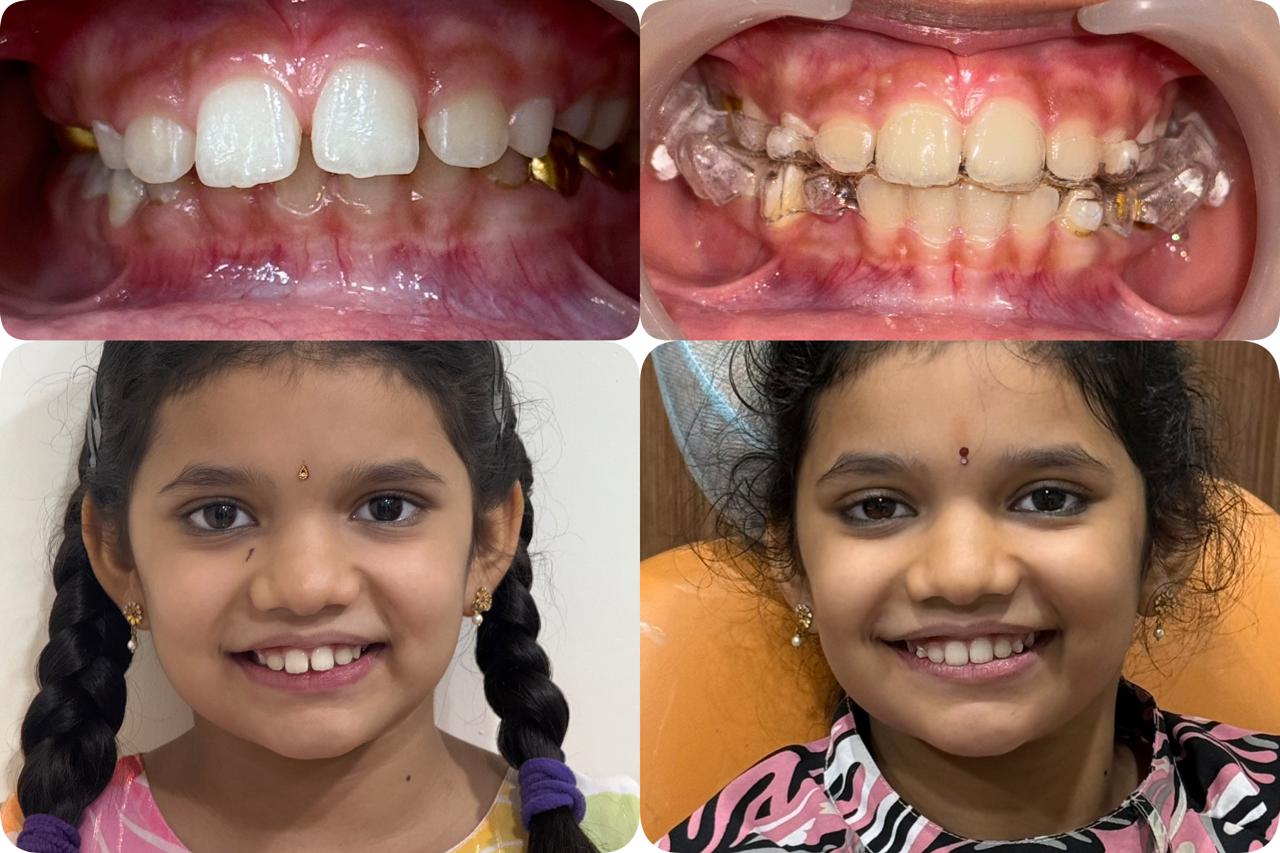 Simply Smilez Dental Clinic Gallery 12