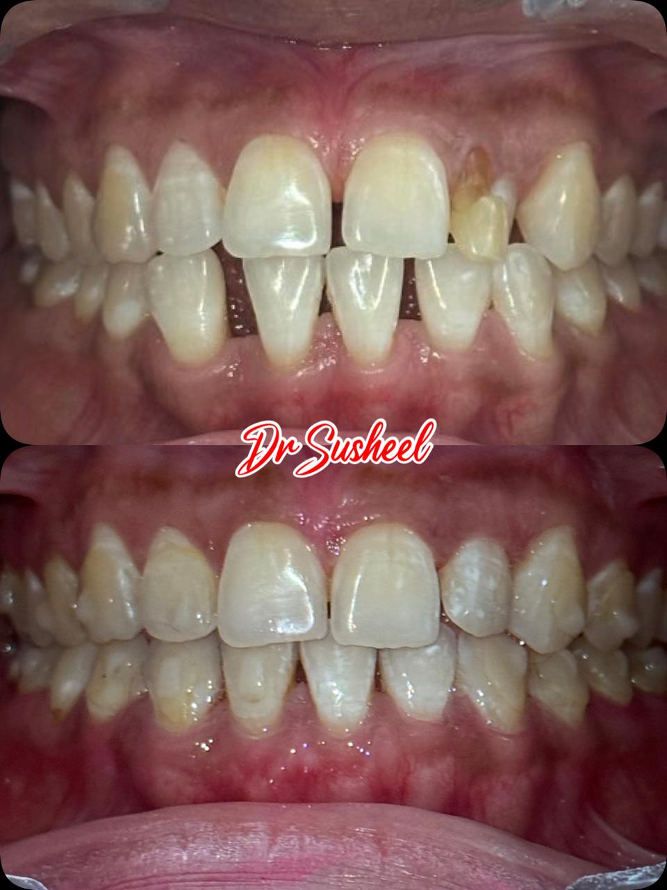 Simply Smilez Dental Clinic Gallery 14