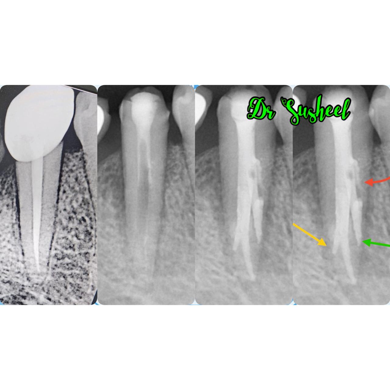 Simply Smilez Dental Clinic Gallery 16