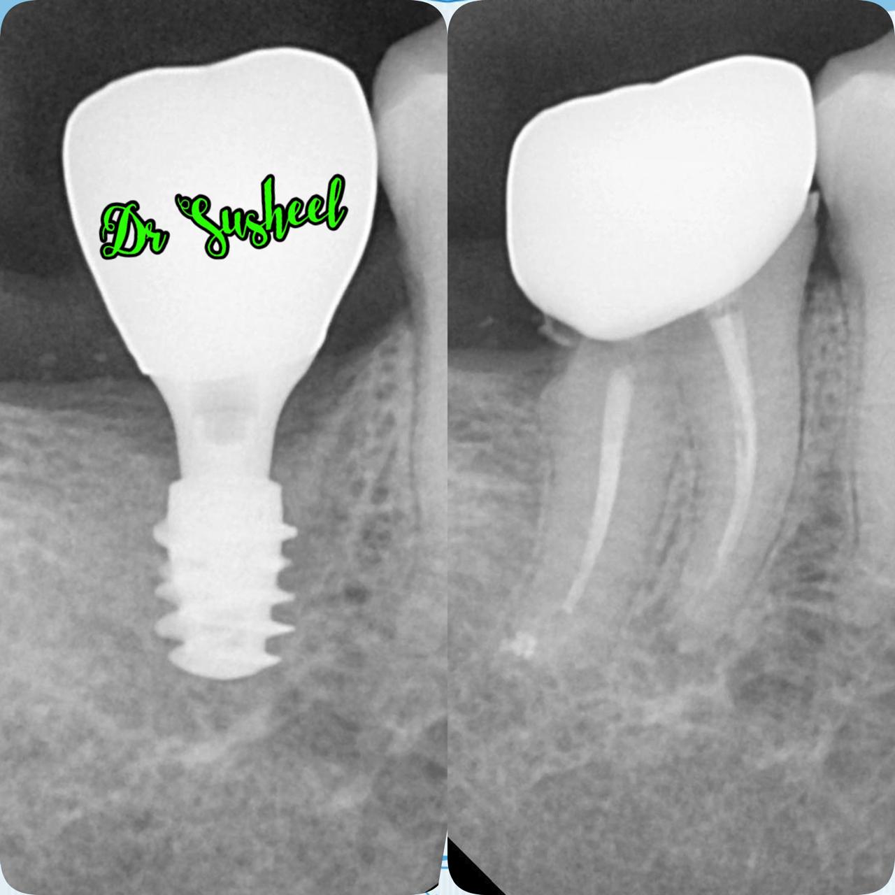 Simply Smilez Dental Clinic Gallery 17