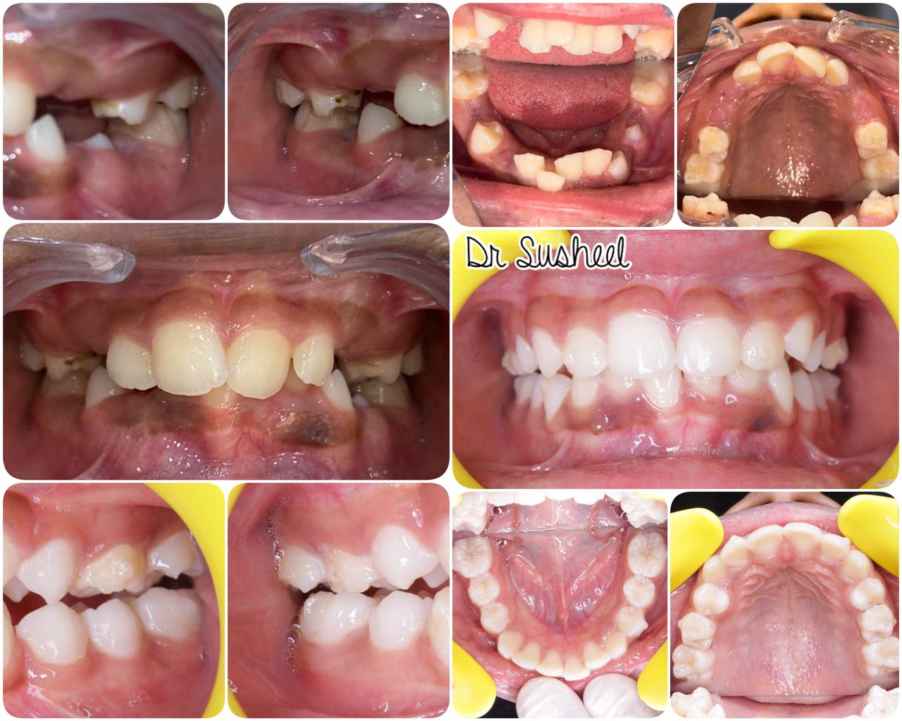 Simply Smilez Dental Clinic Gallery 2