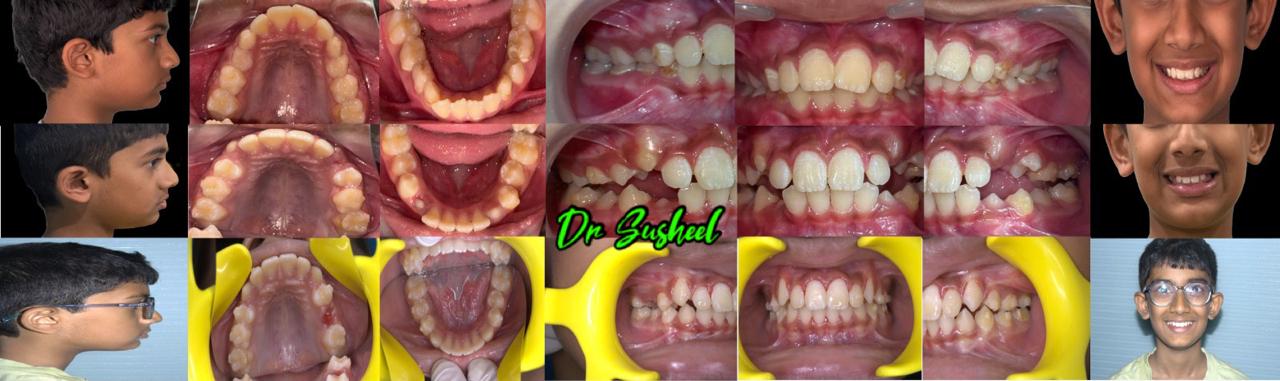 Simply Smilez Dental Clinic Gallery 4