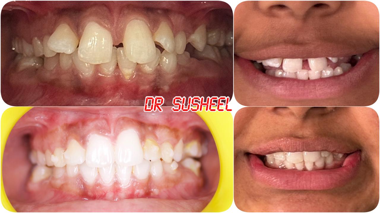 Simply Smilez Dental Clinic Gallery 7