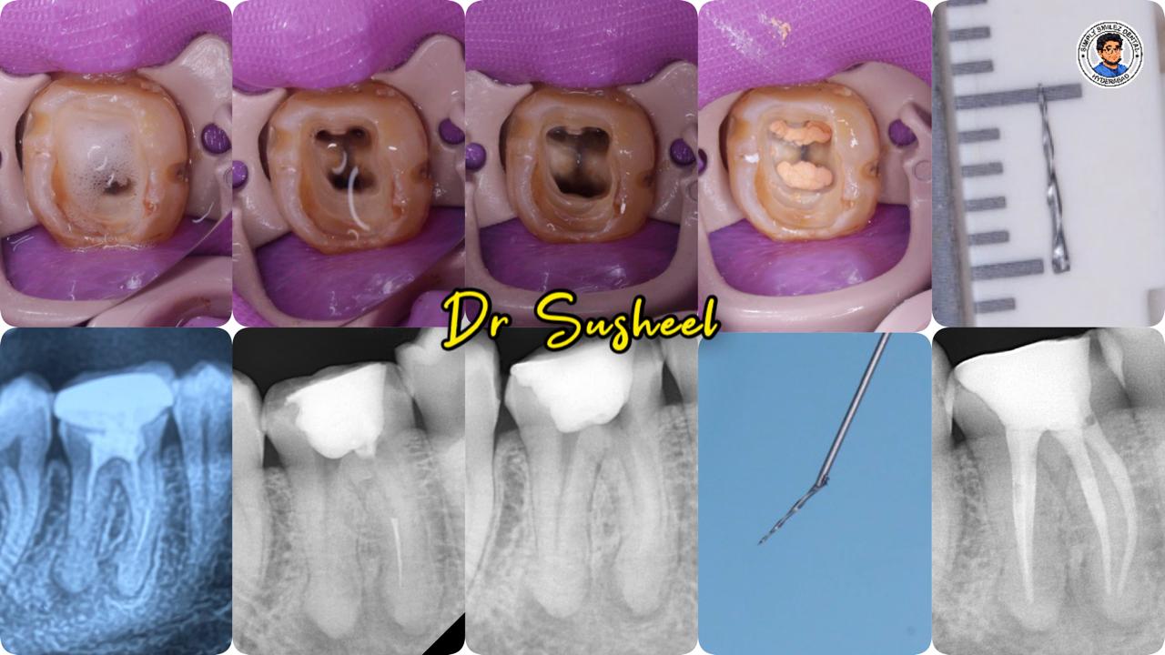 Simply Smilez Dental Clinic Gallery 9